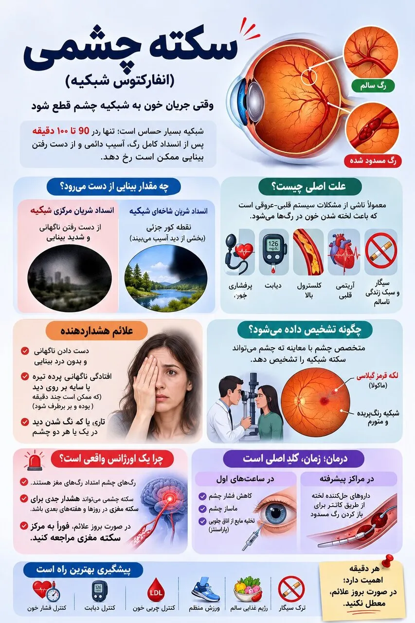 درباره سکته چشمی؛ یک اورژانس واقعی چشم‌پزشکی