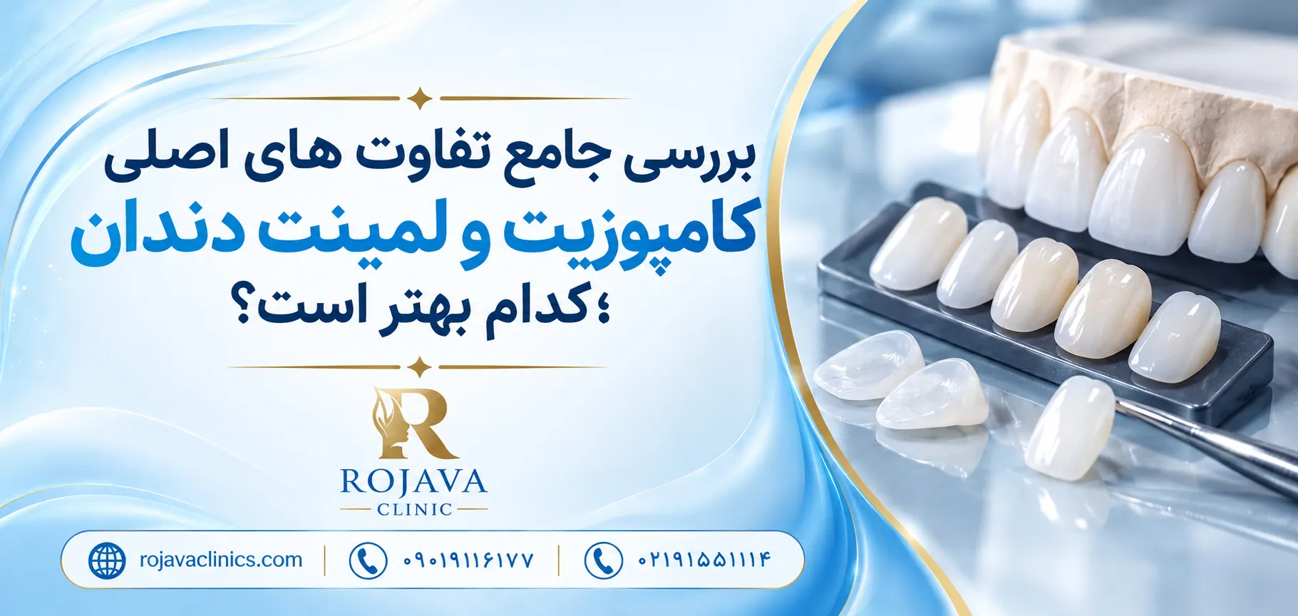 لمینت بهتر است یا کامپوزیت دندان؟ بررسی 7 تفاوت اصلی + مزایا و معایب لمینت بهتر است یا کامپوزیت دندان؟ بررسی 7 تفاوت اصلی + مزایا و معایب