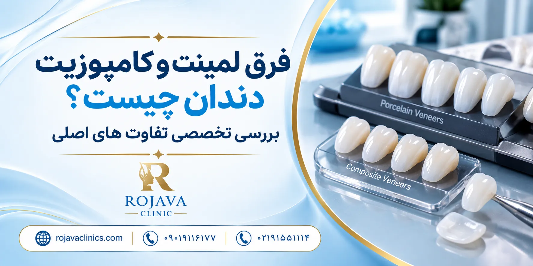 لمینت بهتر است یا کامپوزیت؟ بررسی تفاوتهای این دو روش زیبایی دندان